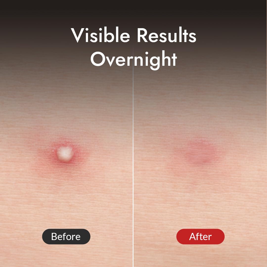 MIZON Good Bye Blemish Clear Patch - 44ea