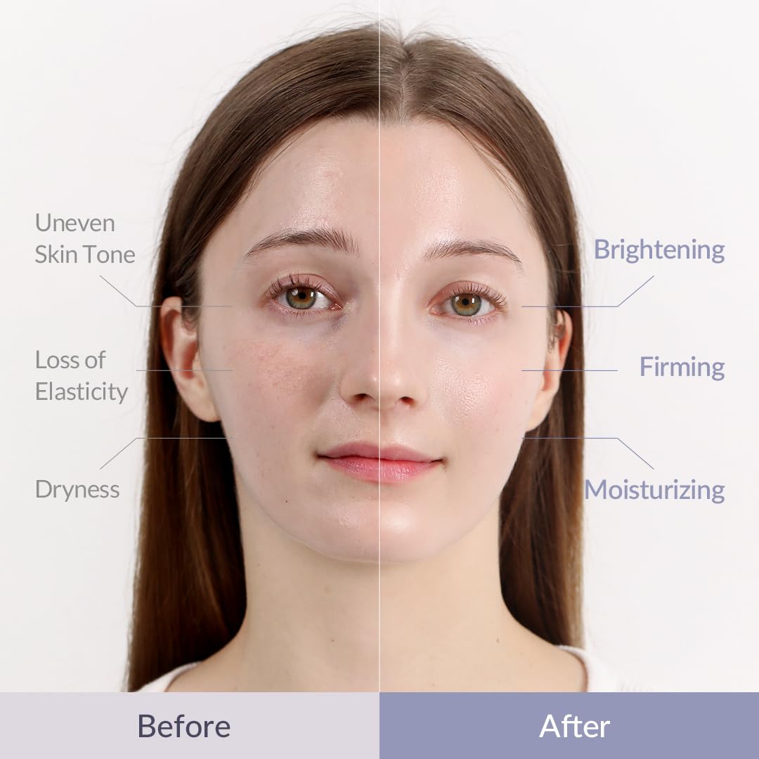 MIZON Hyalugen Pearl Jelly Face Mask (5 Pack)