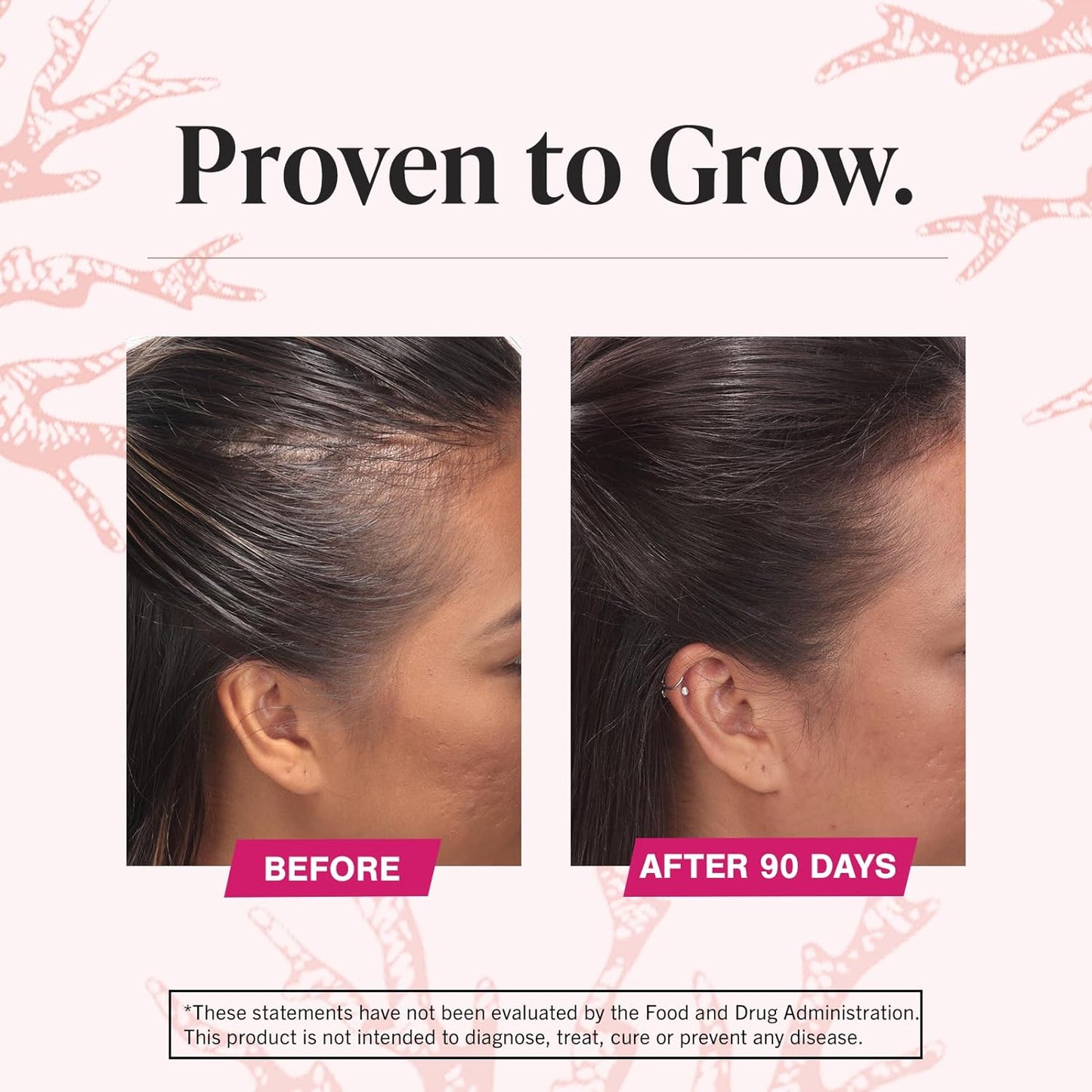 Viviscal Hair Growth Supplements for Women to Grow Thicker 60 Count
