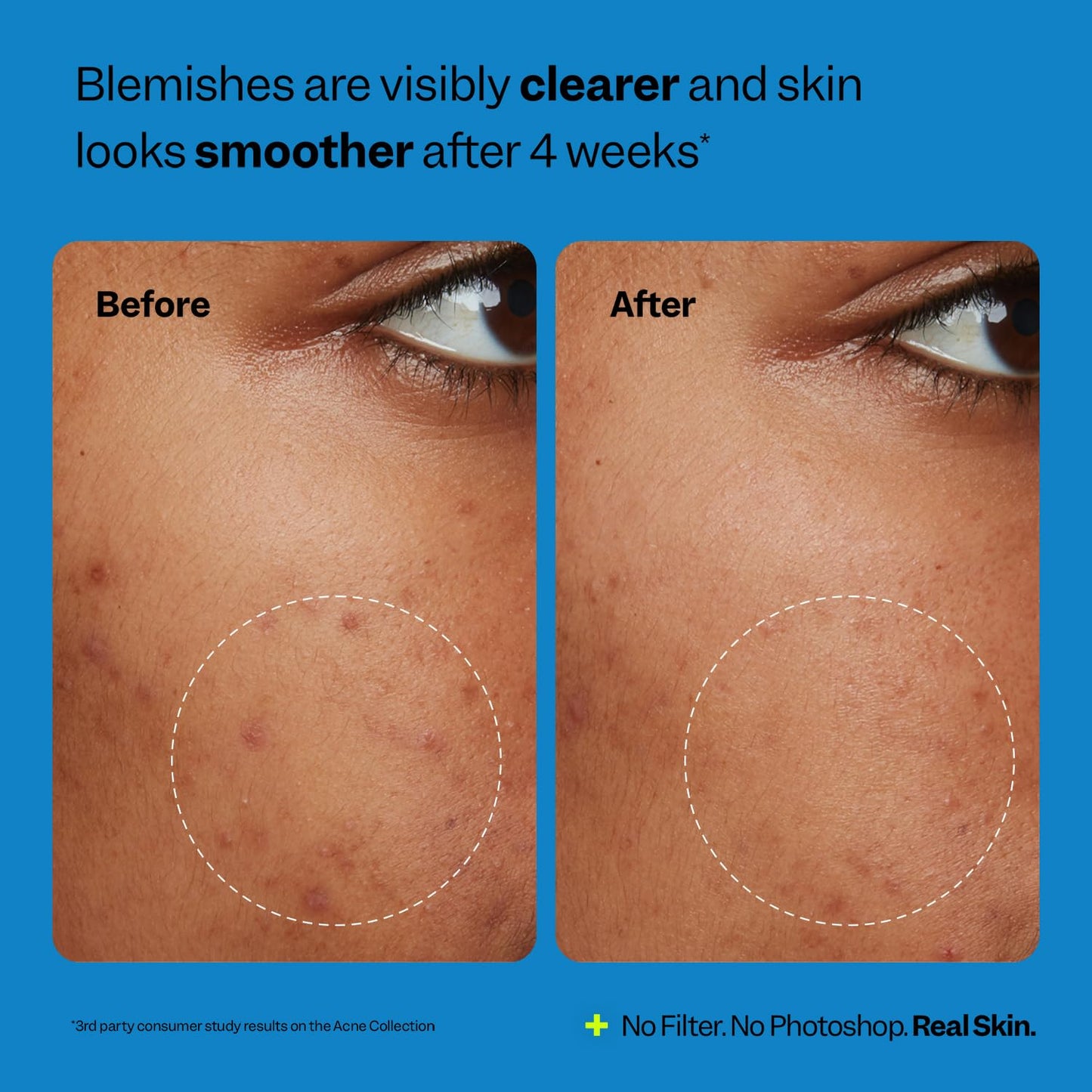 Peach Slices Oil-Free Moisturizer with 2% Salicylic Acid & Hyaluronic Acid - 2.82 oz