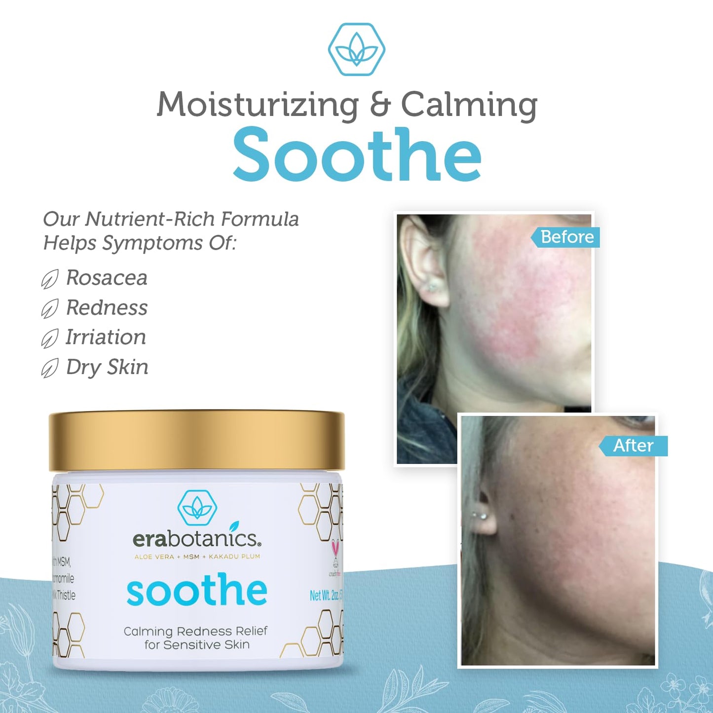 Era Organics Rosacea Relief Cream Soothing Face Moisturizer