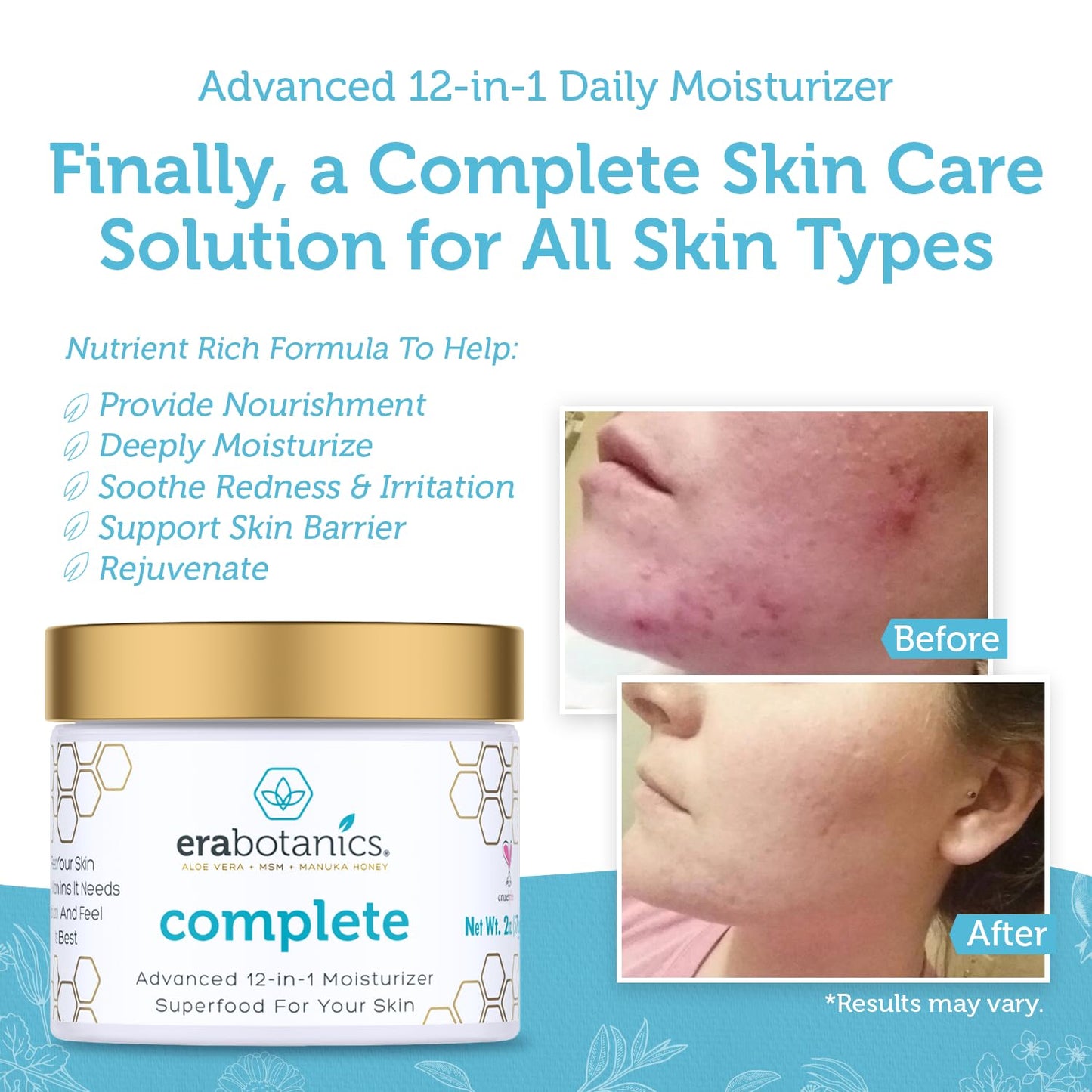 Era Organics Face Moisturizer Cream - Advanced Rejuvenating Facial Cream