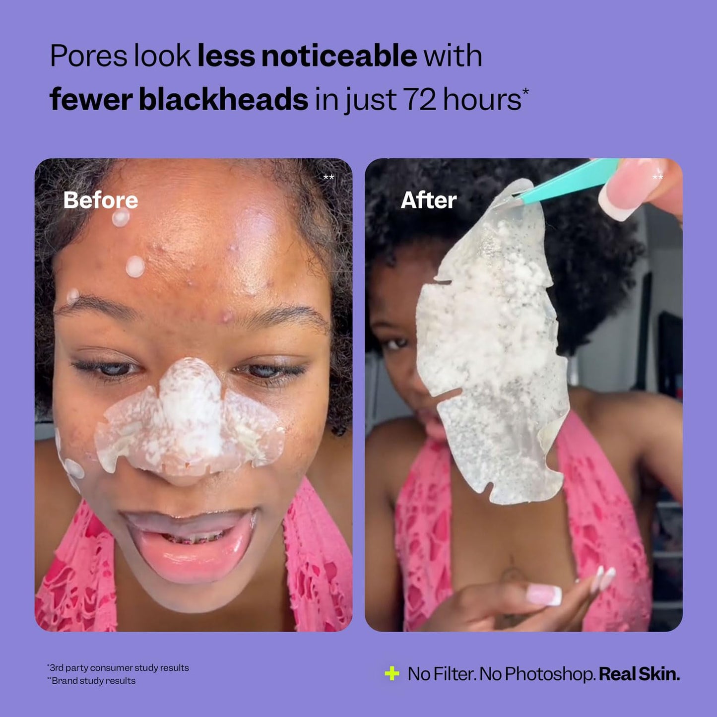 Peach Slices - Nose Pore Patches (7 ct)