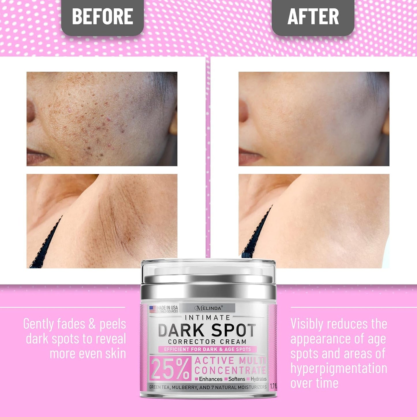 Dark Spot Corrector Cream for Face, Body & Sensitive Areas