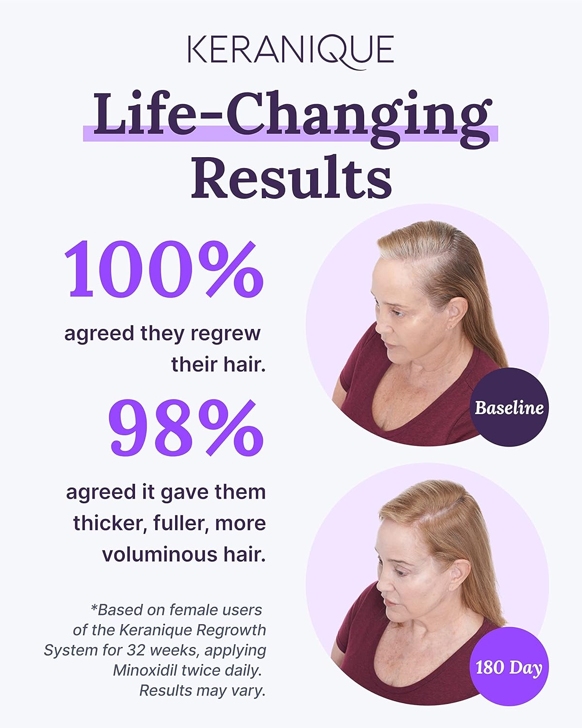 Keranique Hair Regrowth Treatment for Women