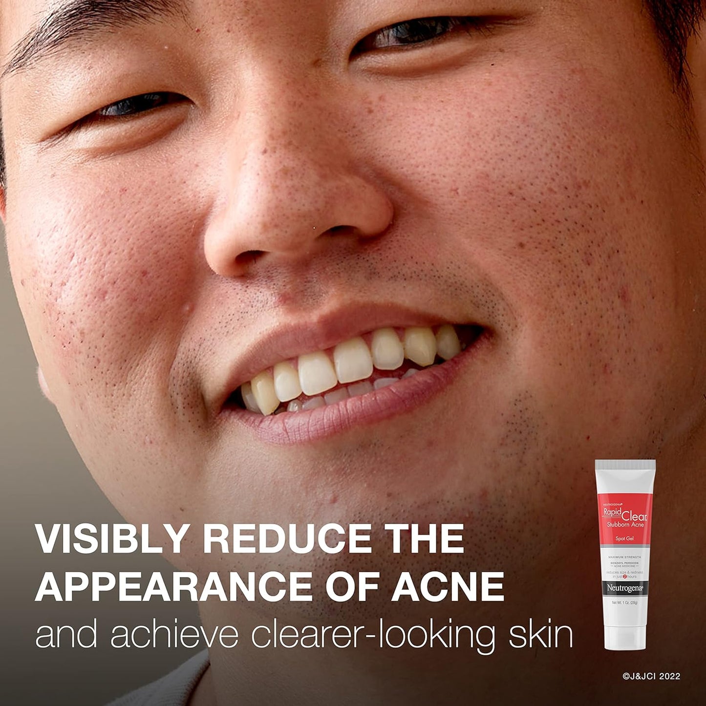 Neutrogena Rapid Clear Stubborn Acne Spot Treatment Gel