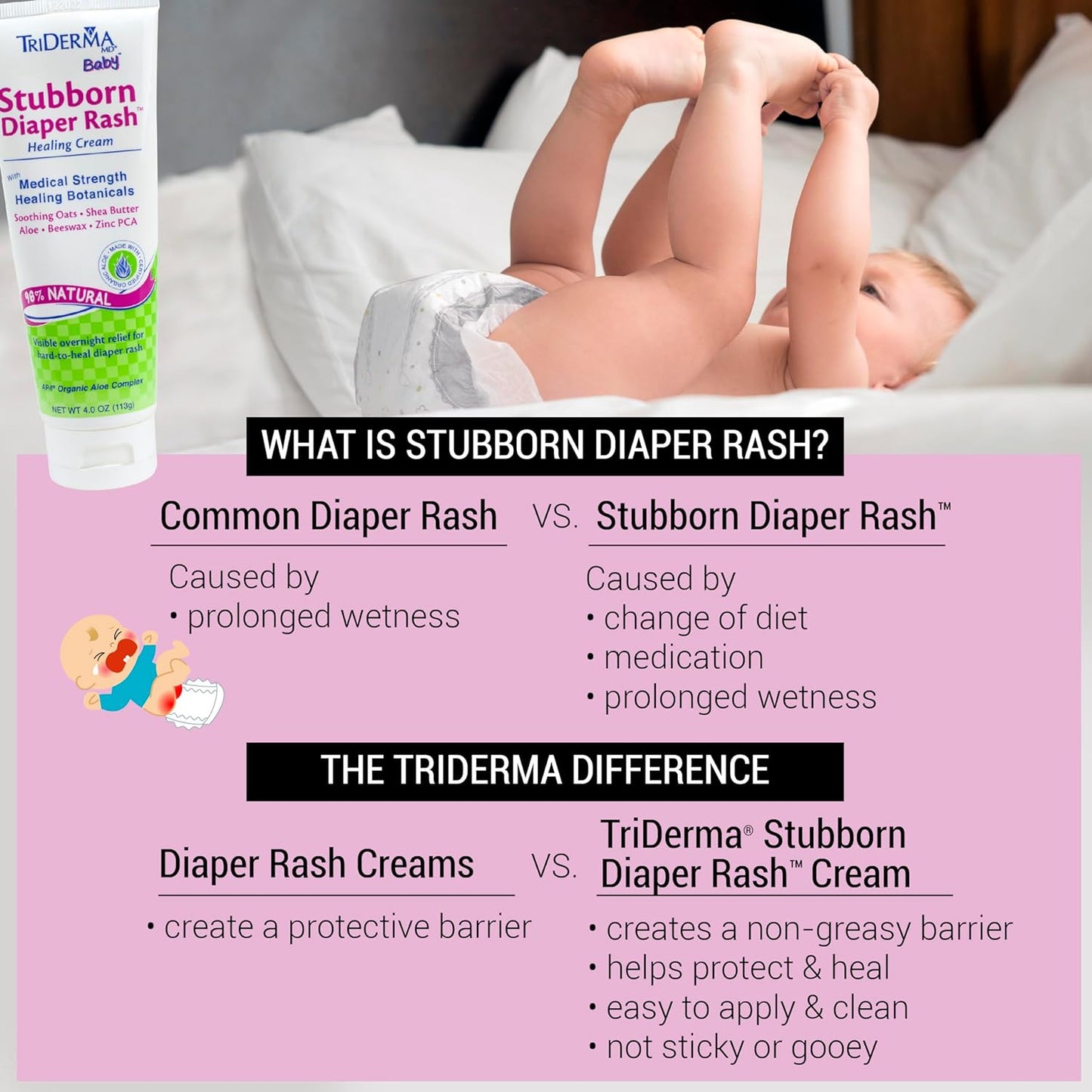 TriDerma MD Baby Stubborn Diaper Rash Relief Cream, 4 oz
