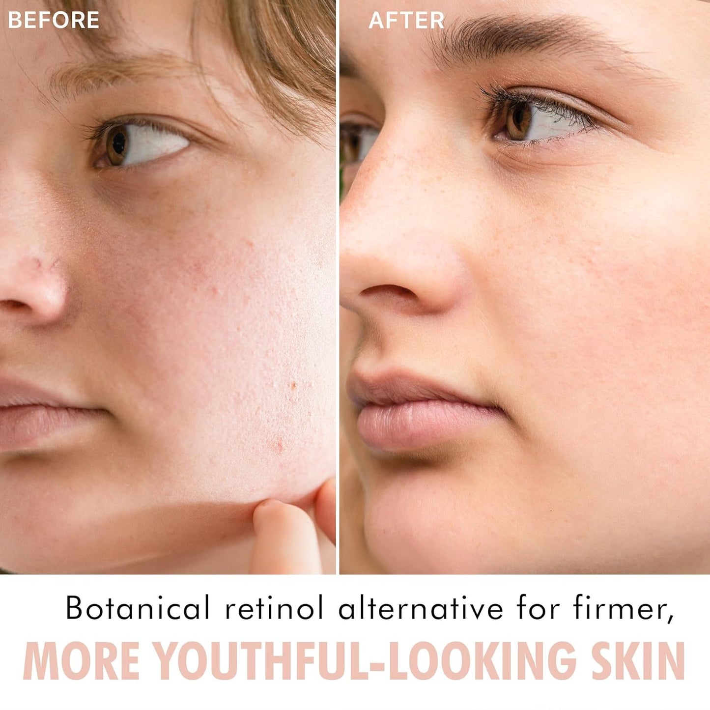 Beauty By Earth Bio Retinol Alternative Bakuchiol Serum -1 fl oz