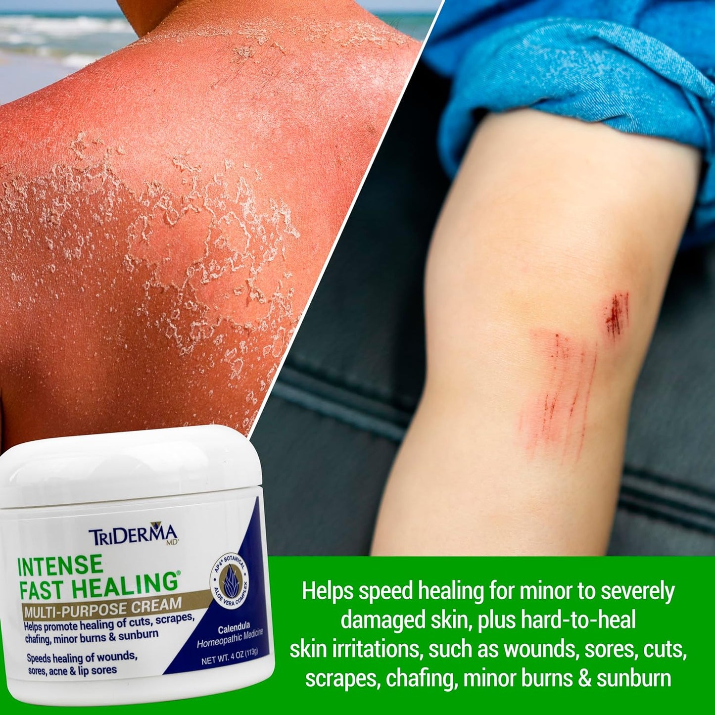 TriDerma Intense Fast Healing Cream 4 oz