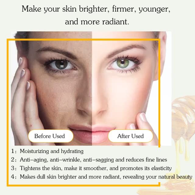 Bealions Retinol Collagen Cream - Hydrating Hyaluronic Acid Face Moisturizer