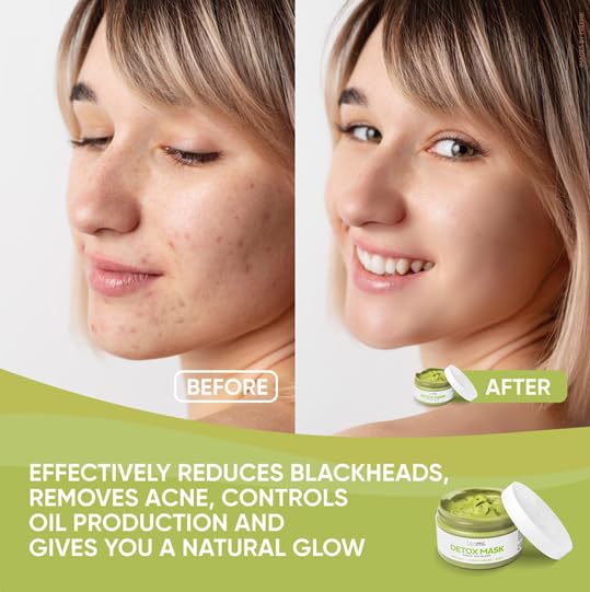 Teami Detox Face Mask for Hydraiting, Moisturizing & Purifying, Blackhead