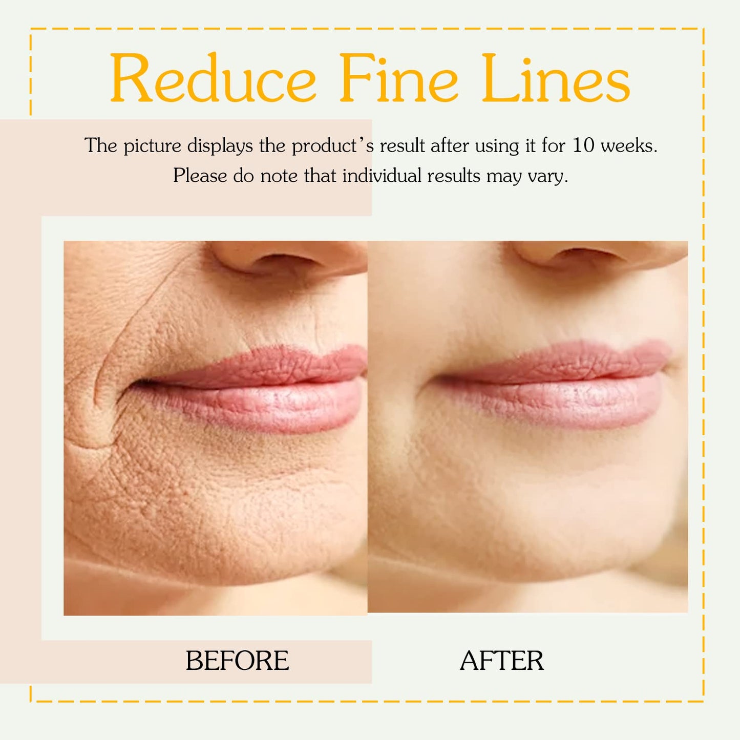 Bealions Retinol Collagen Cream - Hydrating Hyaluronic Acid Face Moisturizer