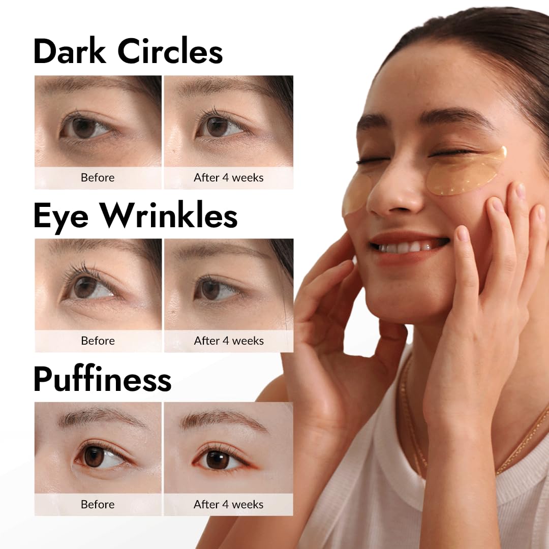 MIZON Under Eye Patches for Puffy Eyes & Dark Circles, 24K Gold & Snail Mucin - 60 Pcs