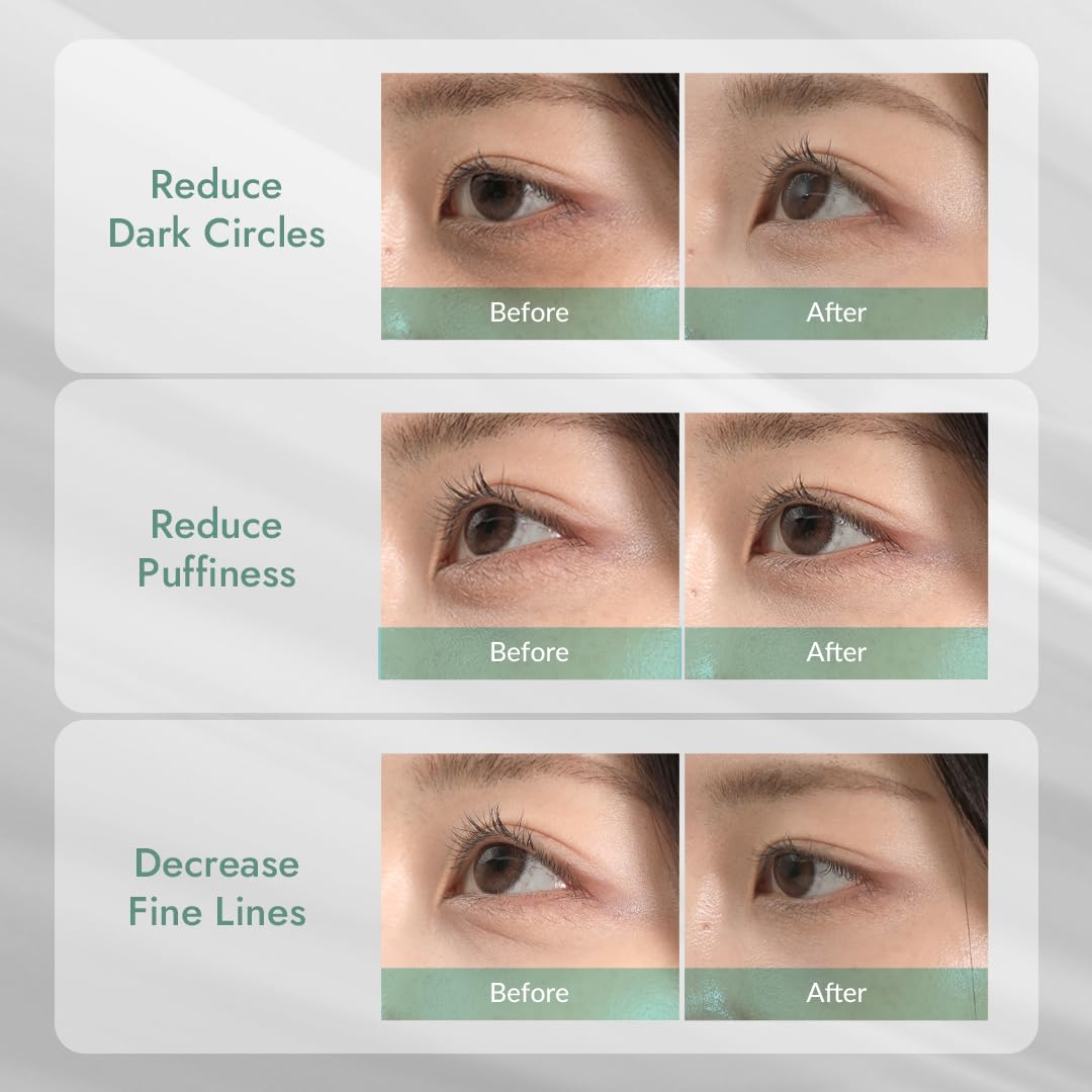 MIZON Cicaluronic Vegan De-puffing Eye Gel Patch - 21 pairs