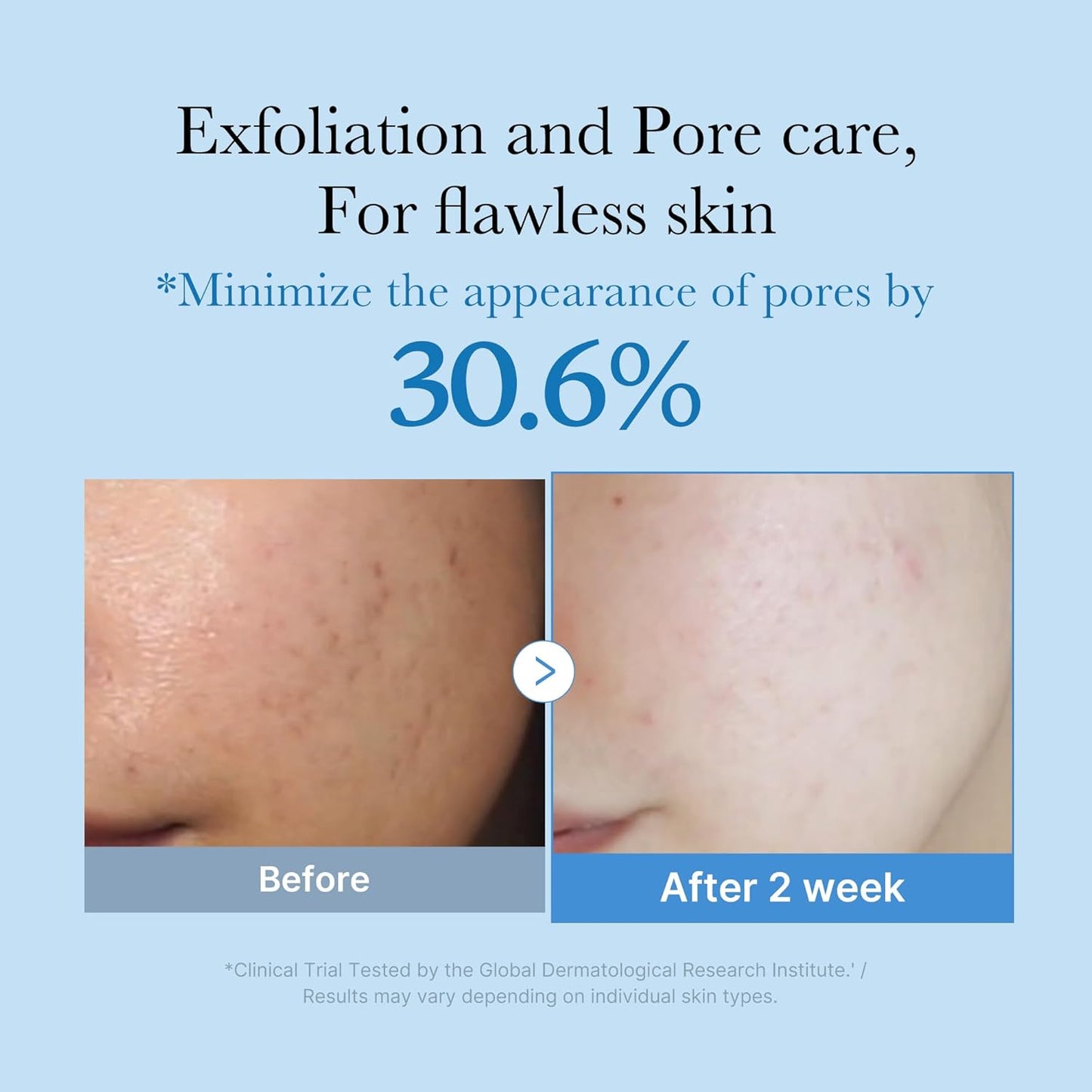 medicube Zero Pore Toner - 8.45 fl. oz