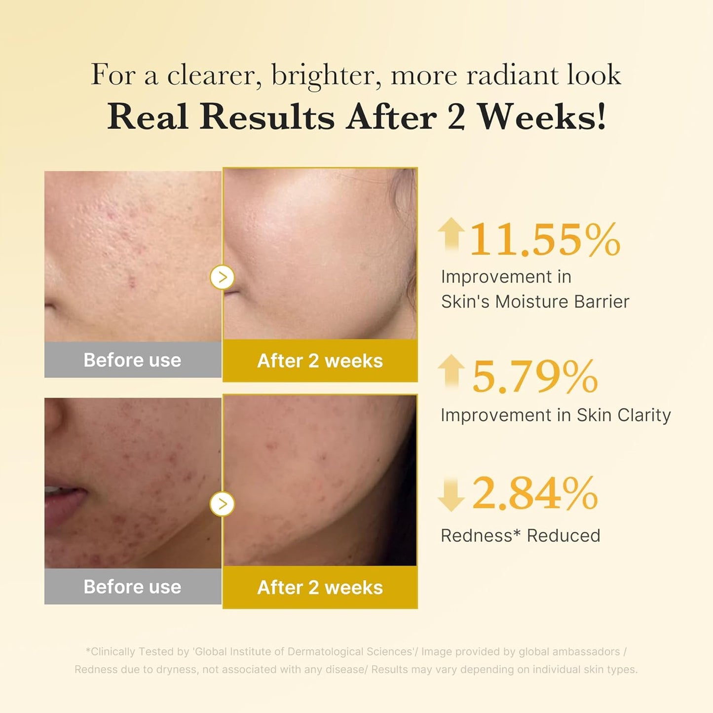 medicube Kojic Acid Turmeric  Niacinamide  Serum - 1.01 fl.oz