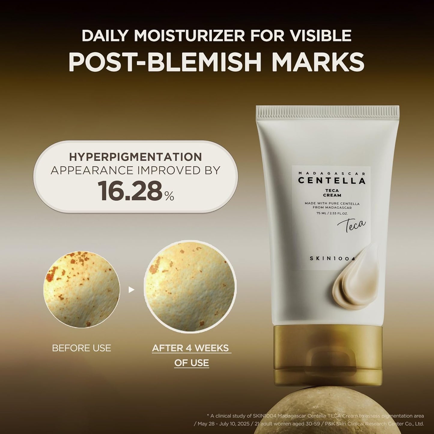 SKIN1004 Madagascar Centella TECA Cream - 2.53 fl.oz
