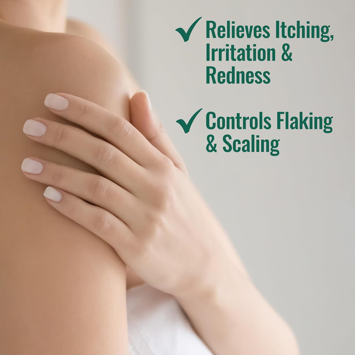 Nizoral Psoriasis Relief Cream, Maximum Strength - 4 Fl Oz