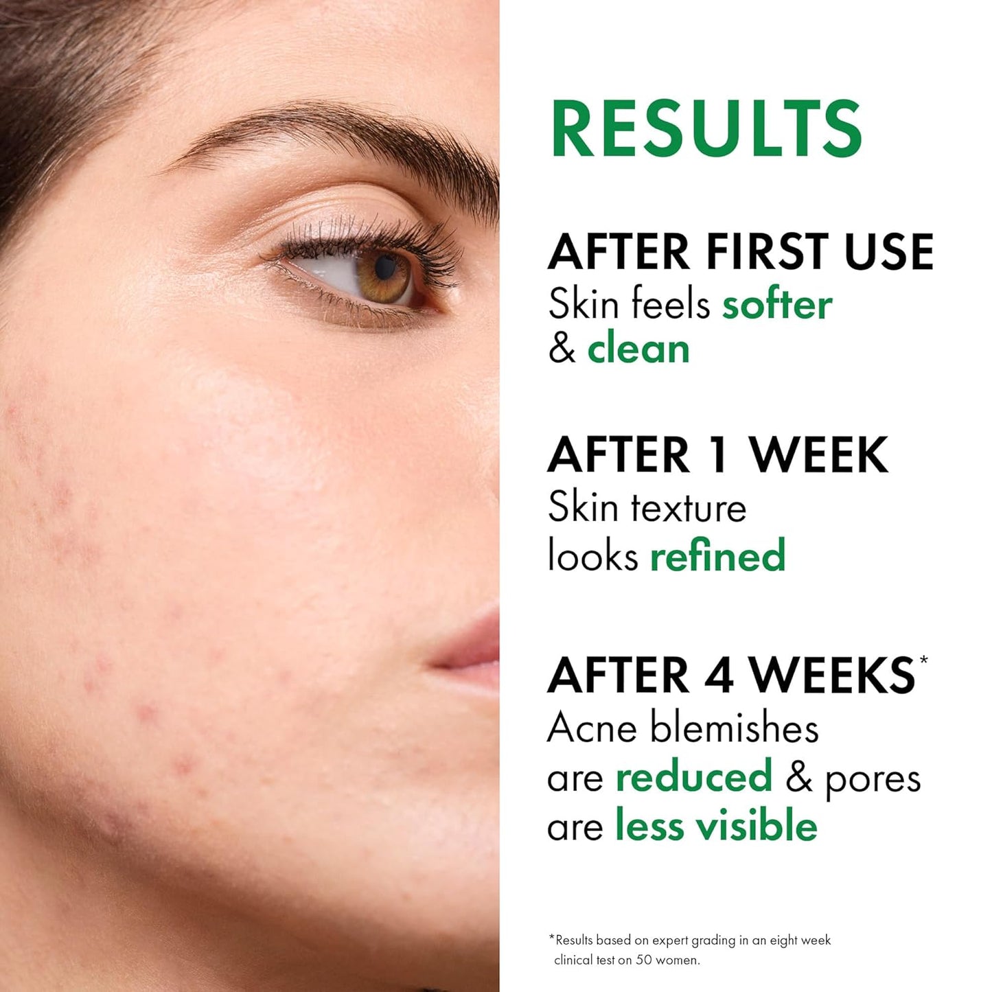 VICHY Normaderm Acne Control Daily Moisturizer -50 ml