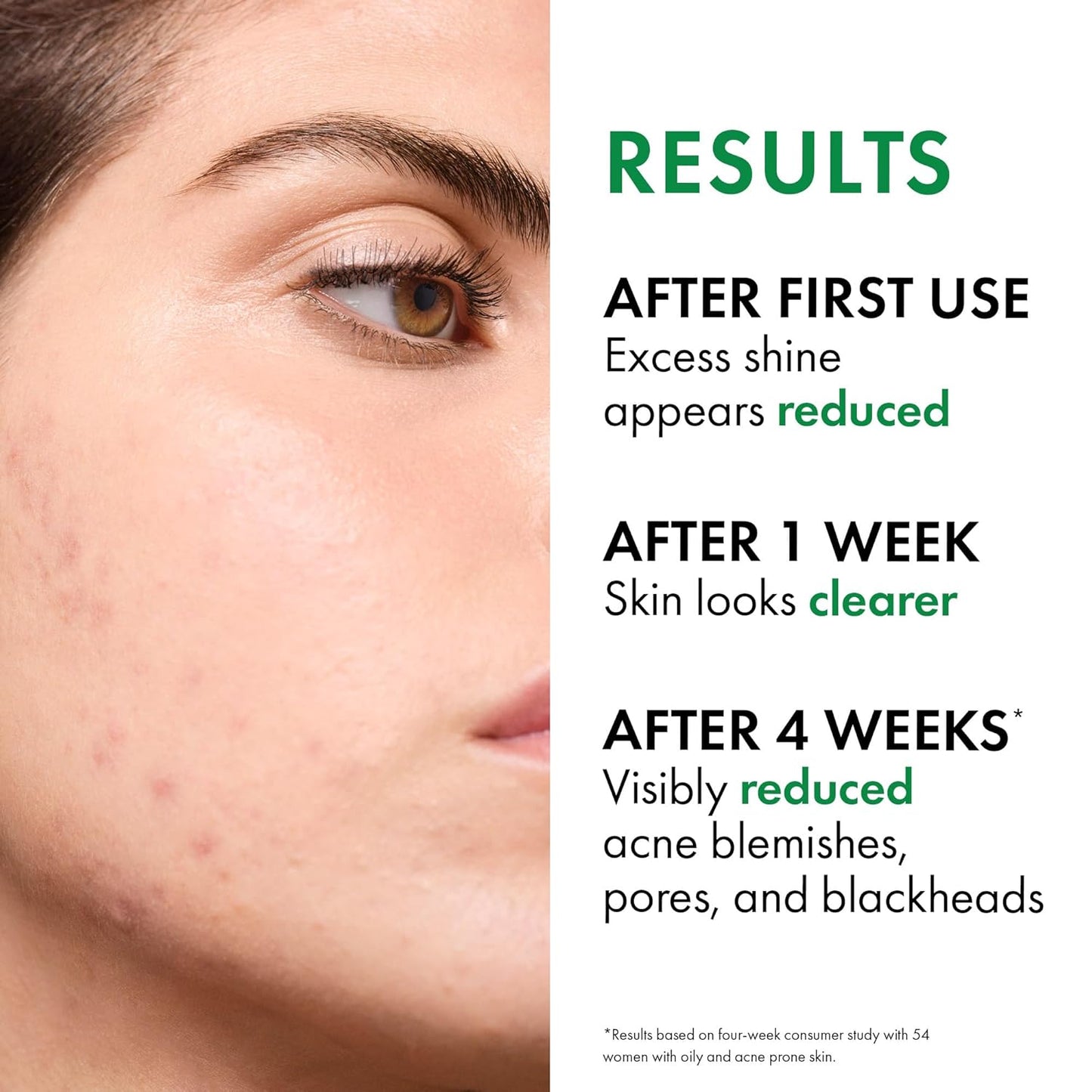 VICHY Normaderm Daily Acne Face Wash, Salicylic Acid Face Cleanser