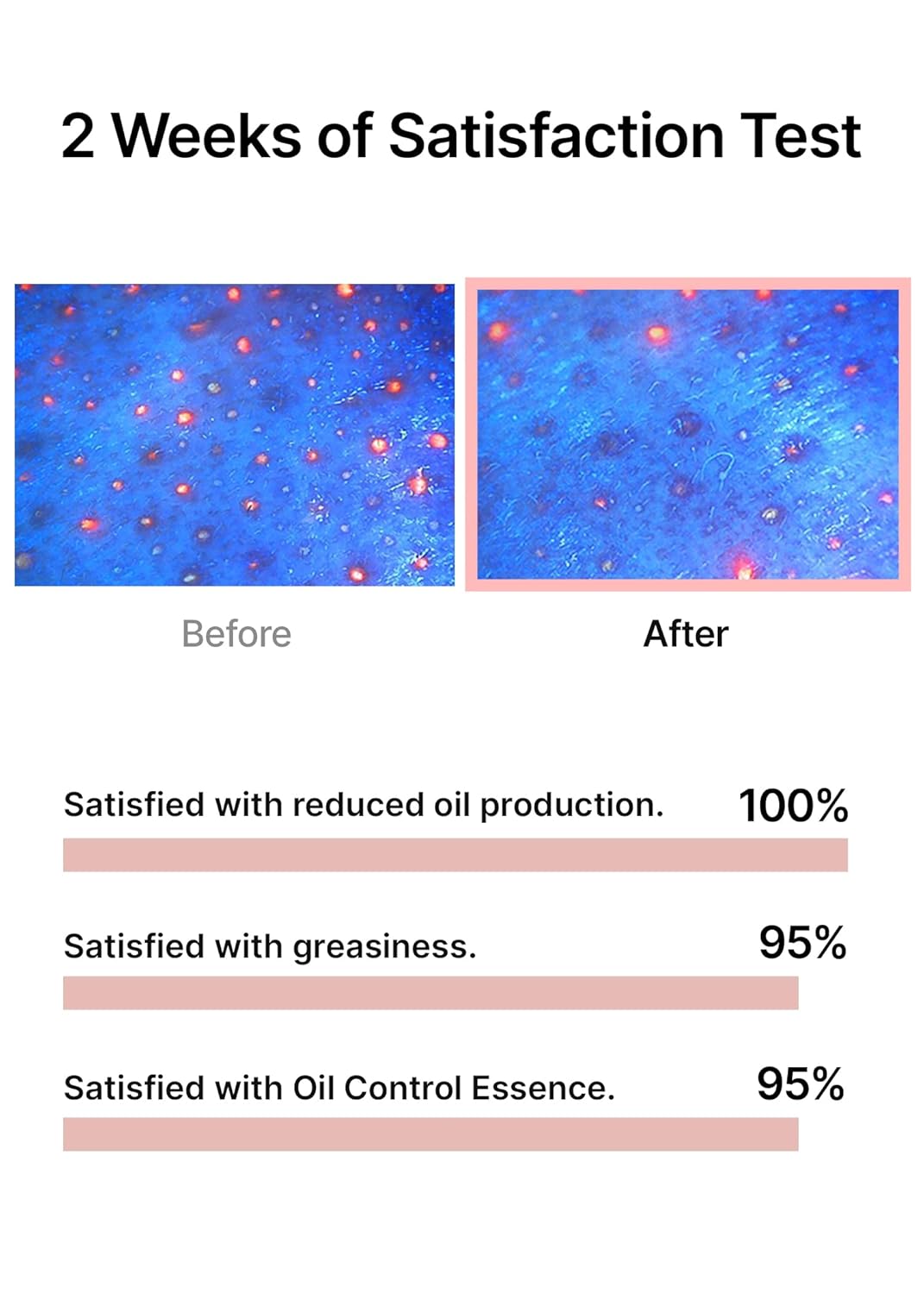 celimax Oil Control Capsule Essence - 30ml