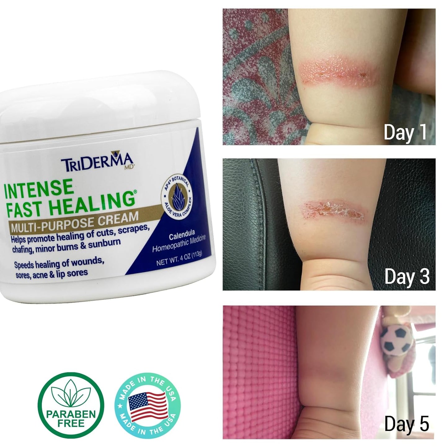 TriDerma Intense Fast Healing Cream 4 oz