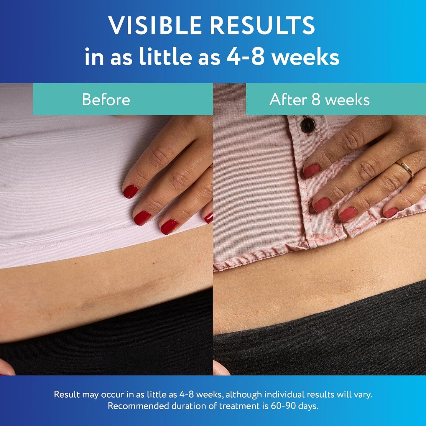 ScarAway Advanced Clear Silicone Scar Sheets - 6 Clear Sheets