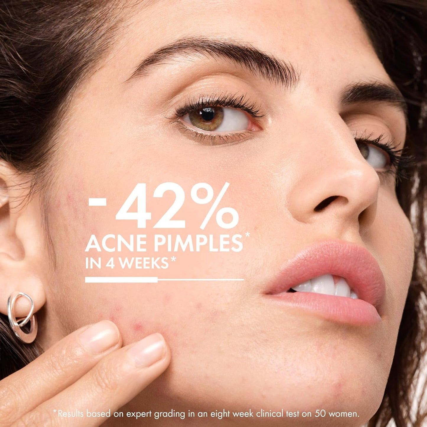 VICHY Normaderm Acne Control Daily Moisturizer -50 ml