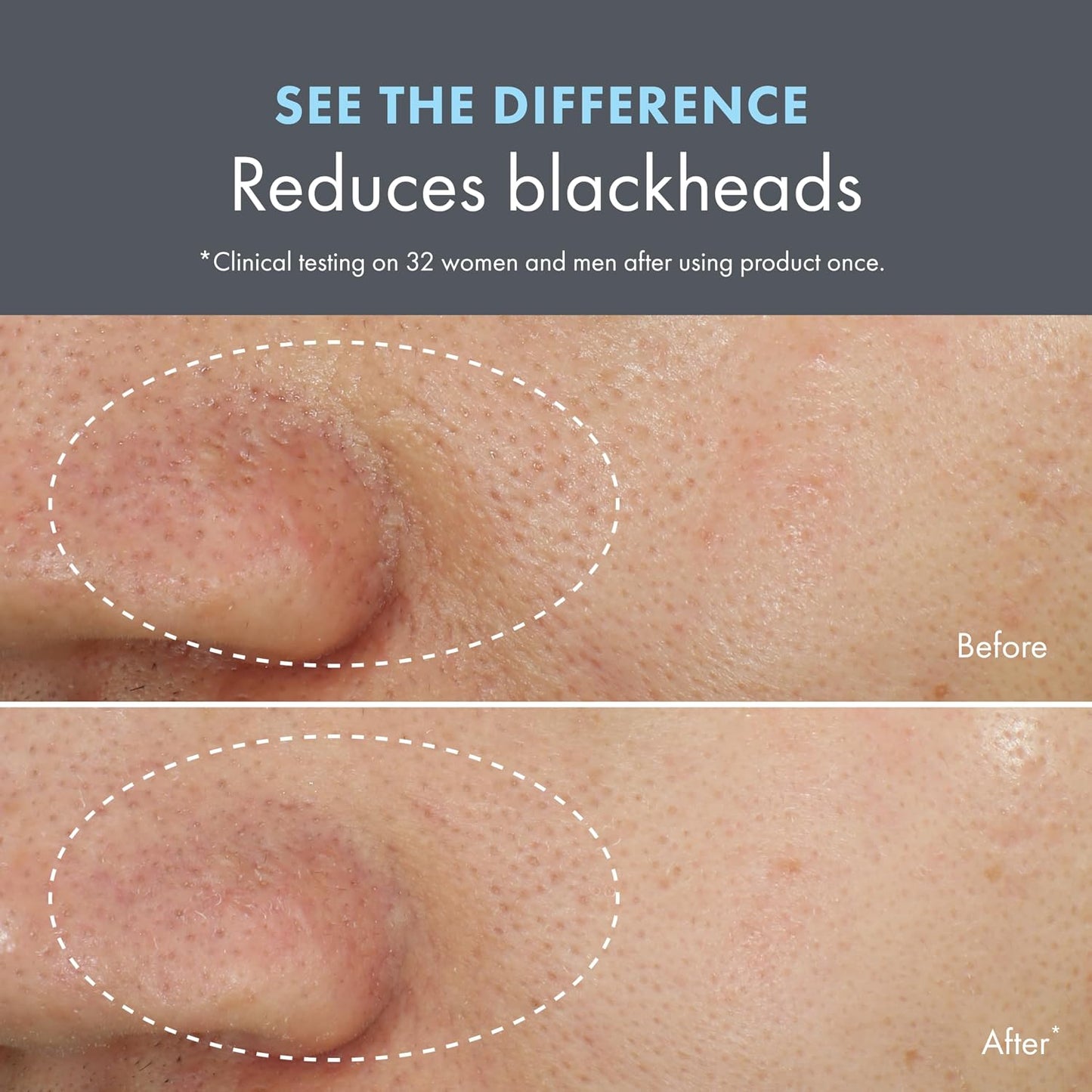 Origins Clear Improvement Blackhead Clearing Face Mask & Scrub - 2.5 Fl Oz