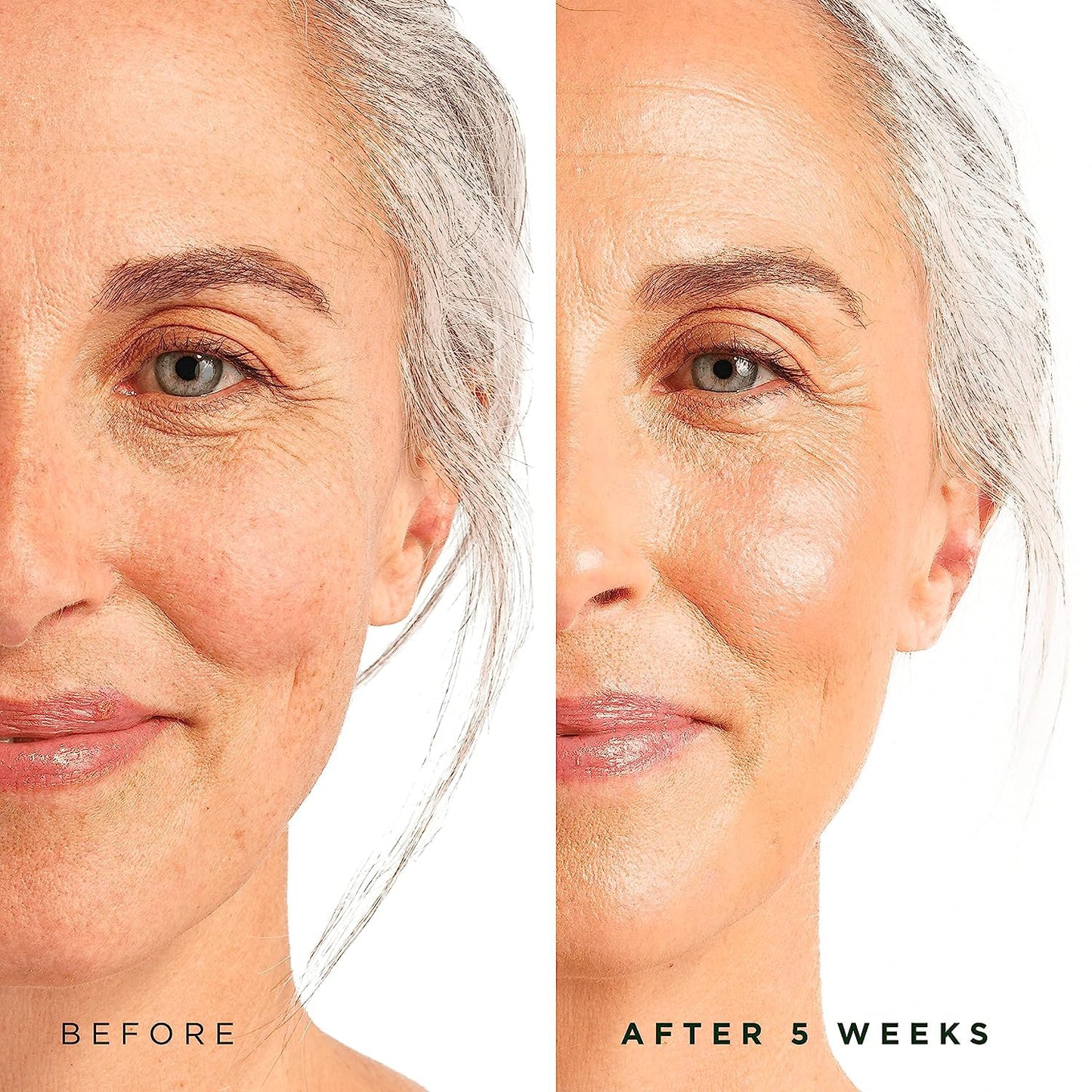 Tree of Life Retinol Serum for Face w/Hydrating Hyaluronic Acid