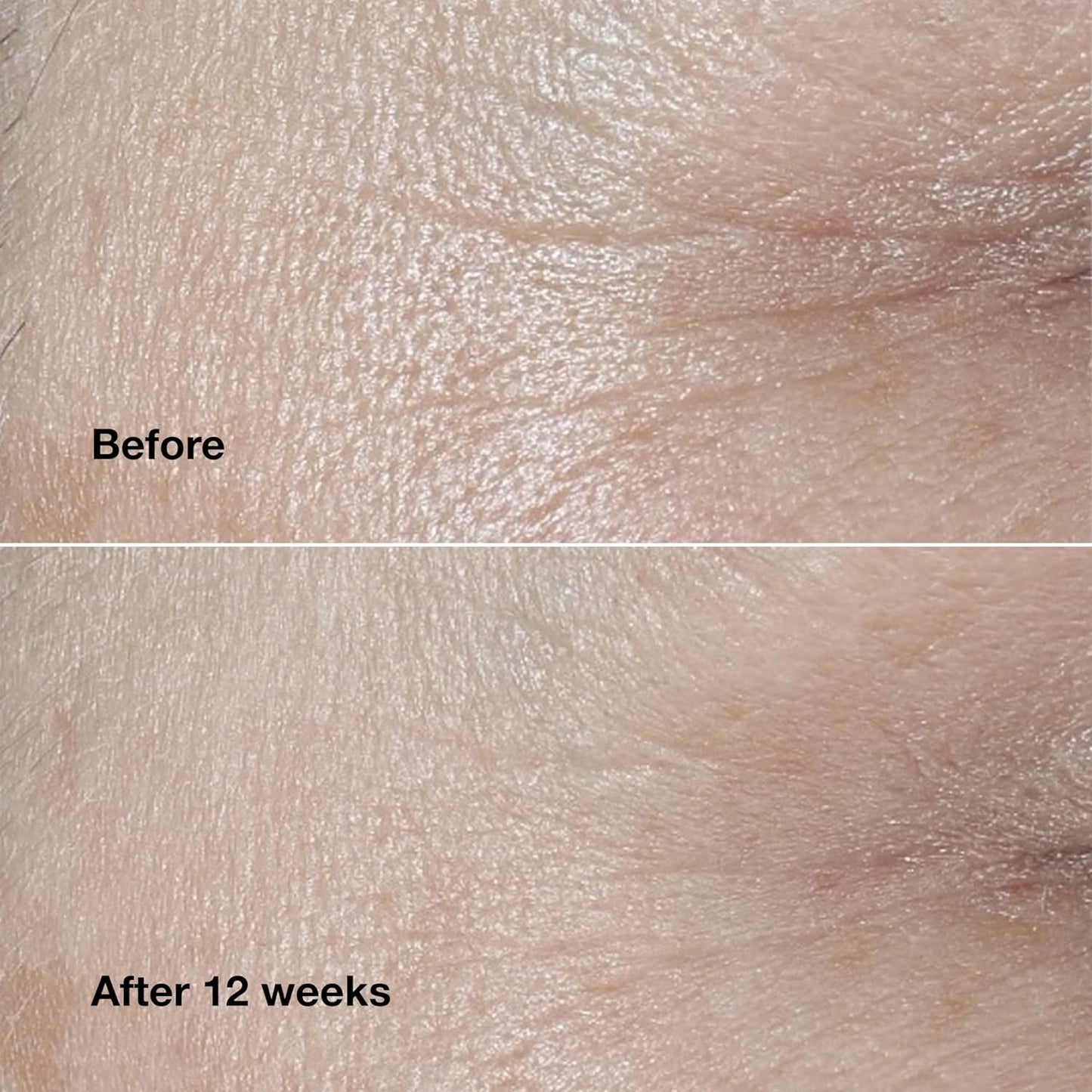 Clinique Smart Clinical Repair Wrinkle Correcting Face Cream