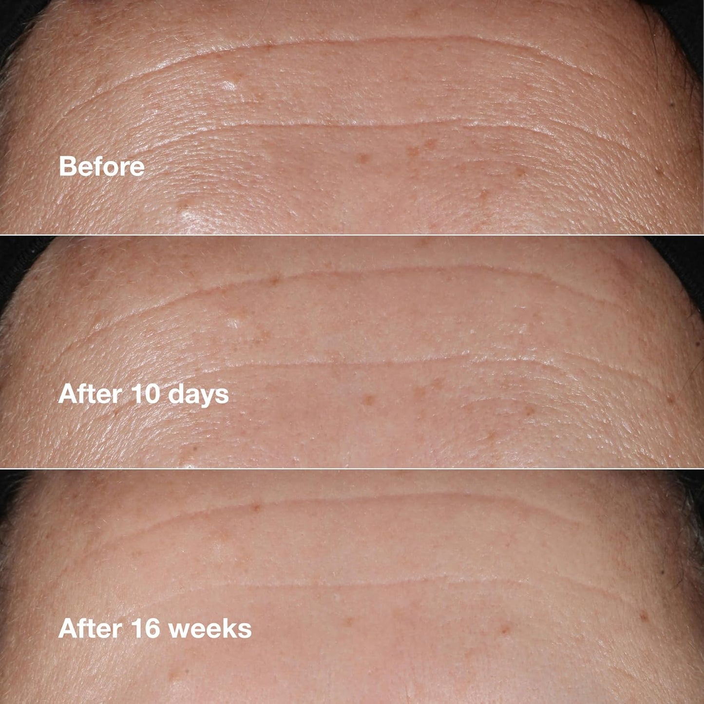 Clinique Smart Clinical Repair Wrinkle Correcting Face Serum